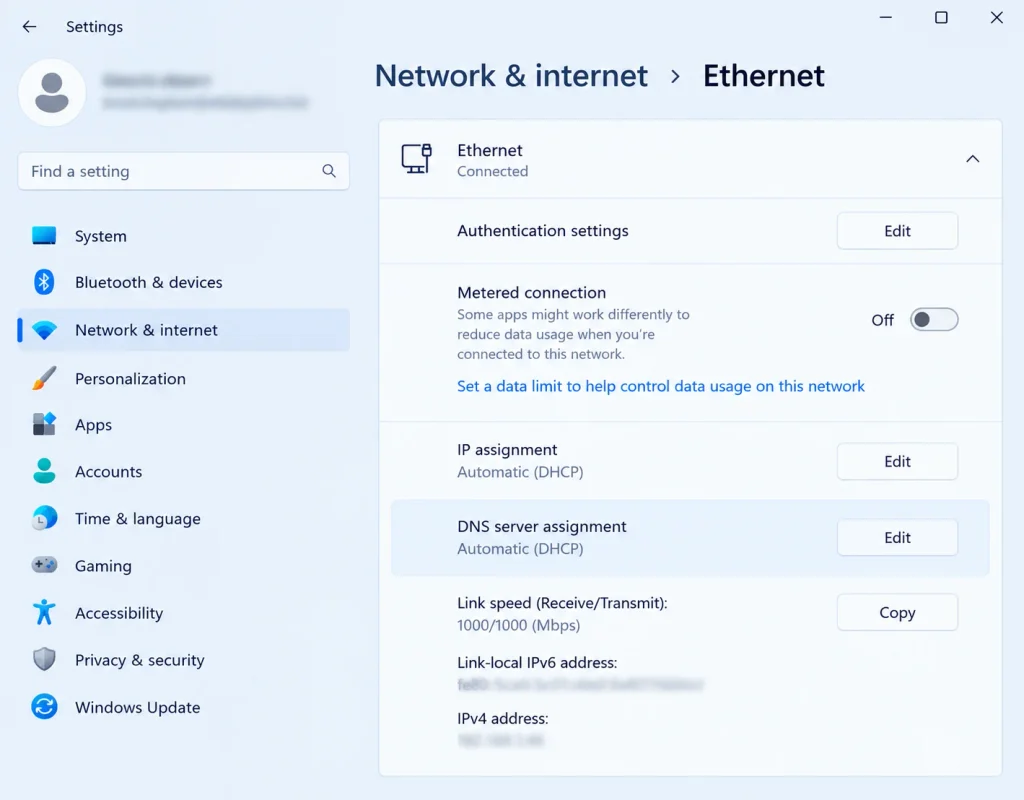 Windows 11 Network and Internet Ethernet settings page showing connected status, IP and DNS assignment set to automatic, and link speed details